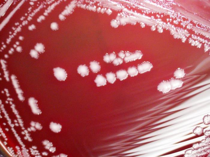 Yersinia pestis bacteria cultured on a sheep blood agar (SBA) medium 120hrs (5x mag). Adapted from Public Health Image Library (PHIL), Centers for Disease Control and Prevention.[6]