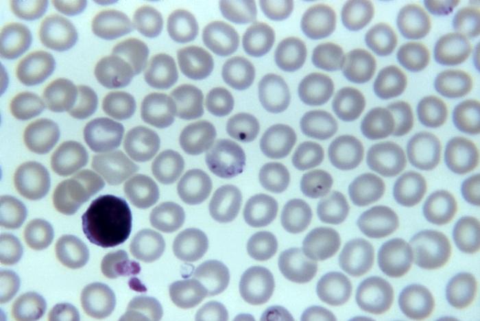 This blood smear micrograph revealed the presence of Babesia sp. ring formations inside the host erythrocytes. From Public Health Image Library (PHIL). [2]