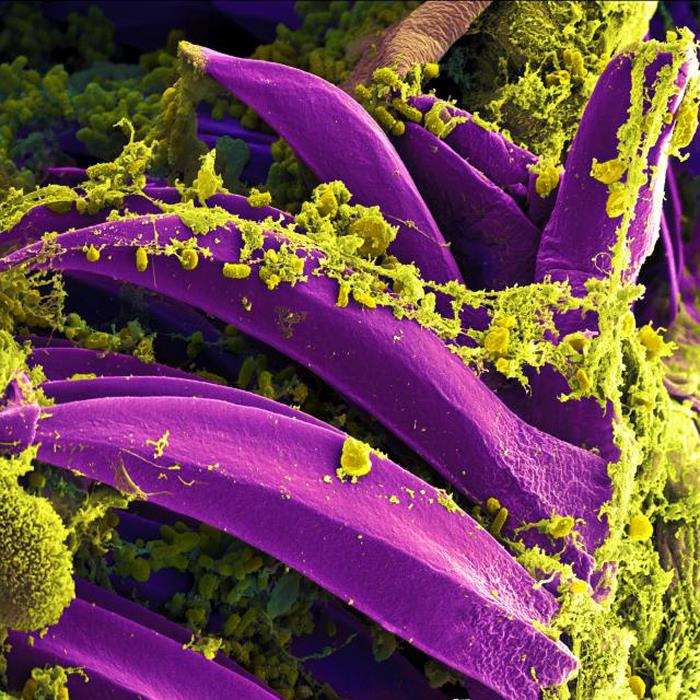 Purple-colored Yersinia pestis bacteria on the proventricular spines of a Xenopsylla cheopis flea. From Public Health Image Library (PHIL). [13]