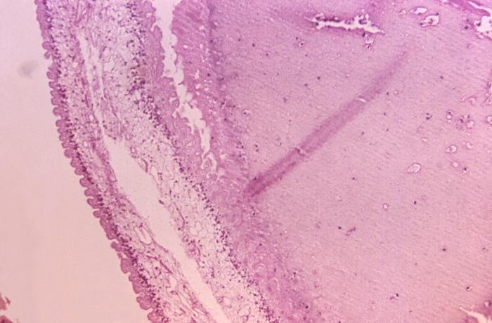 Image reveals the presence of numbers of pork tapeworm, Taenia solium cysticerci, which had contaminated this sample of porcine muscle tissue. From Public Health Image Library (PHIL). [1]