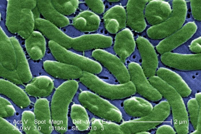 Scanning electron micrograph (SEM) depicts a grouping of Vibrio vulnificus bacteria; Mag. 13184x. From Public Health Image Library (PHIL). [8]