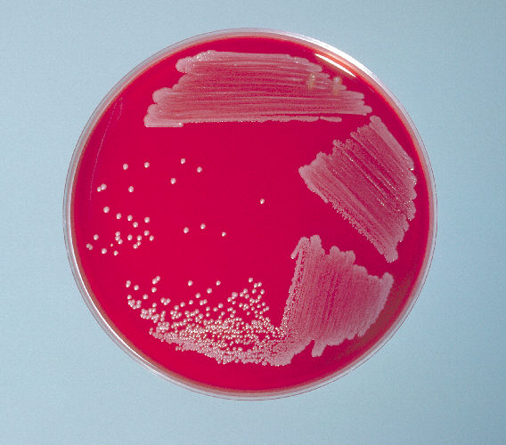 Blood agar plate culture of Corynebacterium diphtheriae (gravis), smooth. From Public Health Image Library (PHIL). [2]