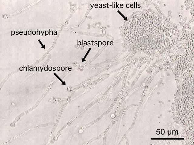 This is a a microscopic image of Candida albicans, grown on cornmeal agar medium. - By Y tambe - Y tambe's file, CC BY-SA 3.0, https://commons.wikimedia.org/w/index.php?curid=233284