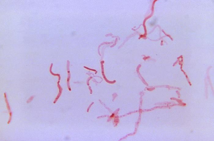 File:Bacteroides08.jpeg