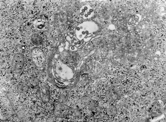 Transmission electron micrograph (TEM) depicts a highly magnified view of a tissue that had been infected with Rift Valley fever (RVF) virus. From Public Health Image Library (PHIL). [1]