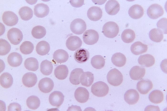 Thin film blood smear micrograph depicts an immature Plasmodium malariae schizont, which contains three chromatin masses, a light cytoplasm, and a dark pigment Adapted from Public Health Image Library (PHIL), Centers for Disease Control and Prevention.[6]