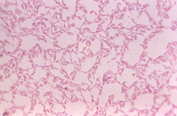 File:Bacteroides25.jpeg