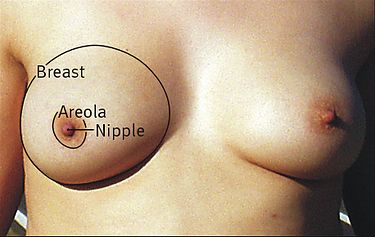 Surface anatomy of the breast