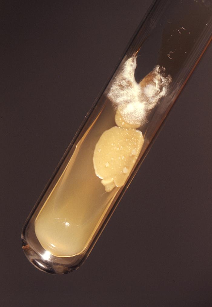 Test tube slant culture, which had been colonized by Cryptococcus neoformans and Histoplasma capsulatum. From Public Health Image Library (PHIL). [1]