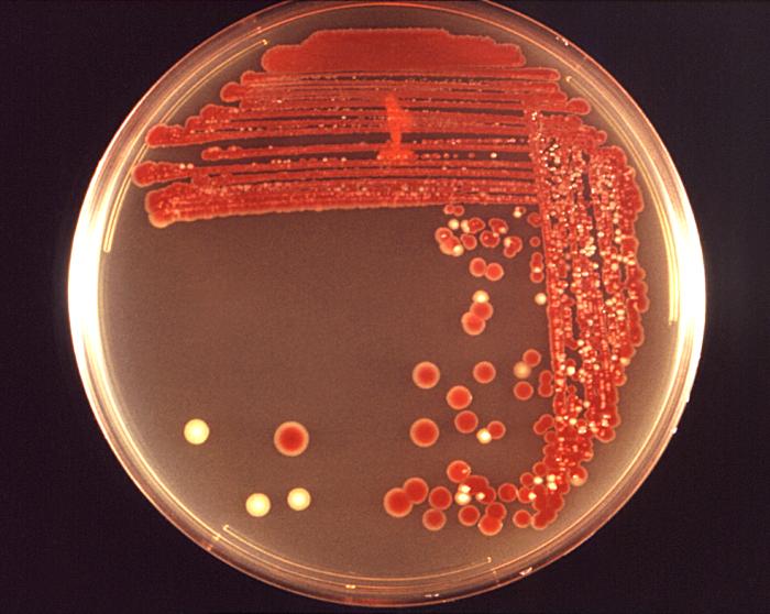 Blood agar base plate cultivated colonial growth of Gram-negative, rod-shaped and facultatively anaerobic Serratia marcescens bacteria. From Public Health Image Library (PHIL). [10]
