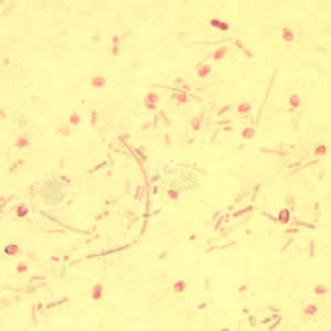 File:Ebieneusi spores chromo2012.jpg
