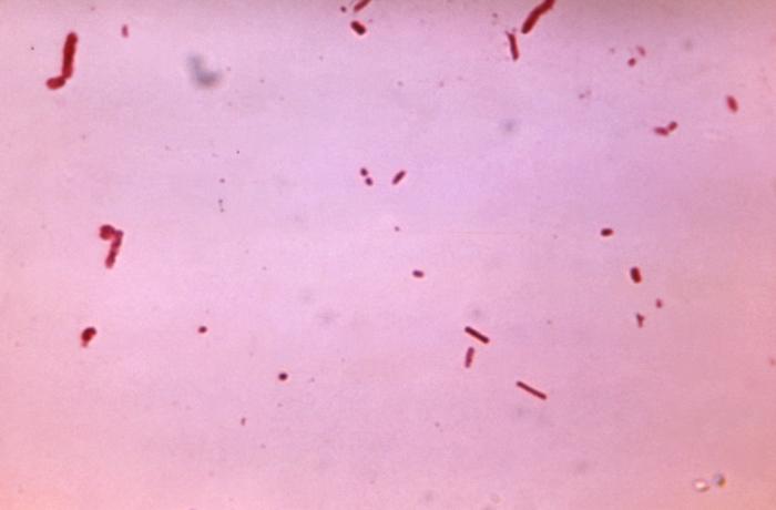 File:Bacteroides04.jpeg