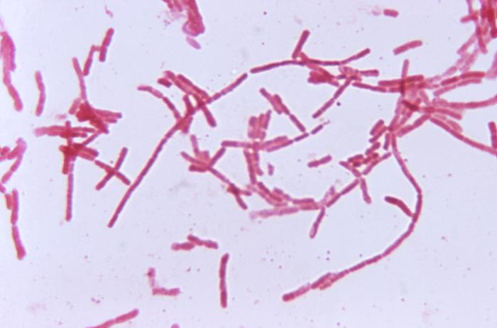 This photomicrograph shows the bacterium Bacteroides biacutus cultured in a thioglycollate medium for 48 hours. From Public Health Image Library (PHIL). [7]