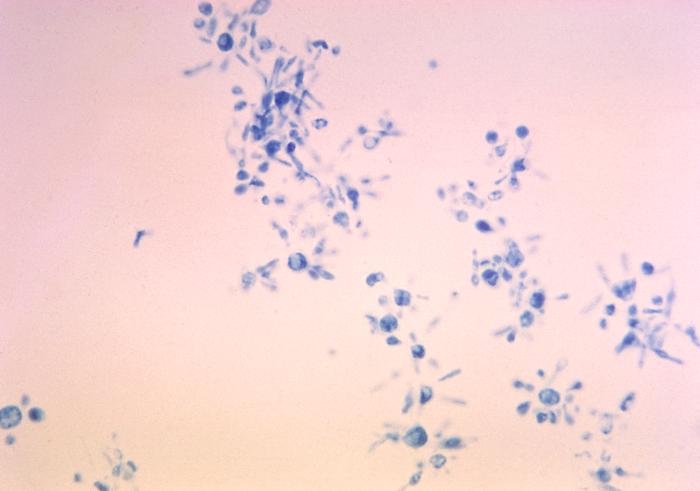 Photomicrograph depicts budding cells of the fungus Paracoccidioides brasiliensis during its yeast phase.. From Public Health Image Library (PHIL). [32]