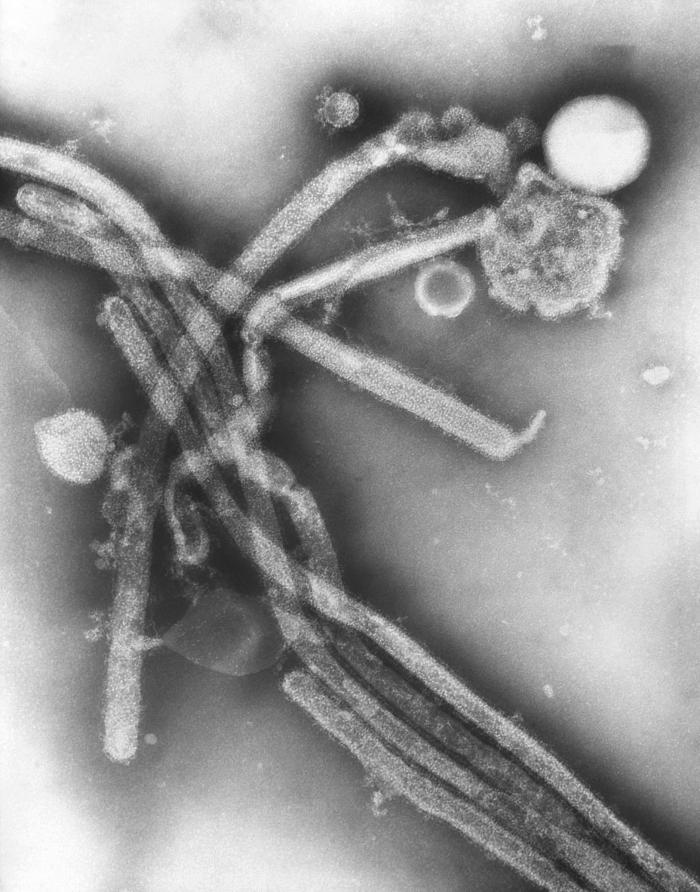 This negatively-stained transmission electron micrograph (TEM) revealed the presence of a number of Hong Kong flu virus virions, the H3N2 subtype of the influenza A virus. This virus is a Orthomyxoviridaevirus family member, and was responsible for the flu pandemic of 1968-1969, which infected an estimated 50,000,000 people in the United States, killing 33,000. Note the proteinaceous coat, or capsid, surrounding each virion, and the hemagglutinin-neuraminidase spikes, which differ in terms of their molecular make-up from strain to strain. Image obtained from Public Health Image Library (PHIL).