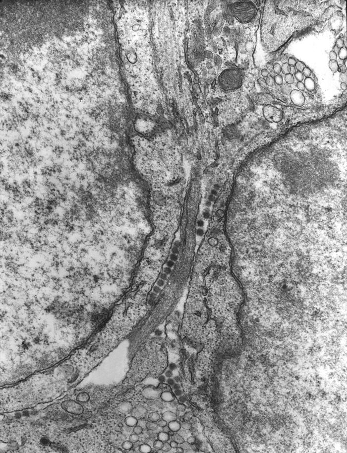 This 1975 transmission electron micrograph (TEM) revealed the presence of a number of Bunyamwera virus virions, a member of the virus family Bunyaviridae, and the genus Bunyavirus. From Public Health Image Library (PHIL). [1]