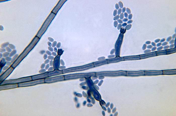 Photomicrograph depicts conidia-laden conidiophores of a Phialophora verrucosa fungal organism from a slide culture. From Public Health Image Library (PHIL). [2]