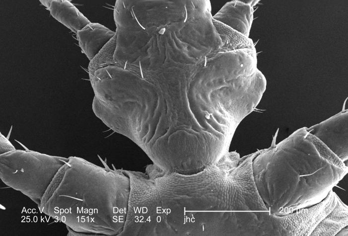 Scanning electron micrographic (SEM) depicts enlarged view of the chitinous, exoskeletal surface of a female louse, Pediculus humanus var. corporis, in the region where the organism’s forelegs and hean attached to its thoracic region. (151X mag). From Public Health Image Library (PHIL). [1]