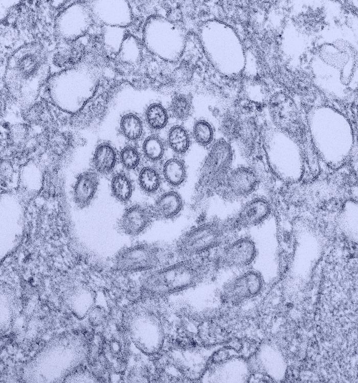 This colorized transmission electron micrograph (TEM) revealed the presence of a number of Novel H1N1 virus virions in this tissue culture sample. Image obtained from Public Health Image Library (PHIL).