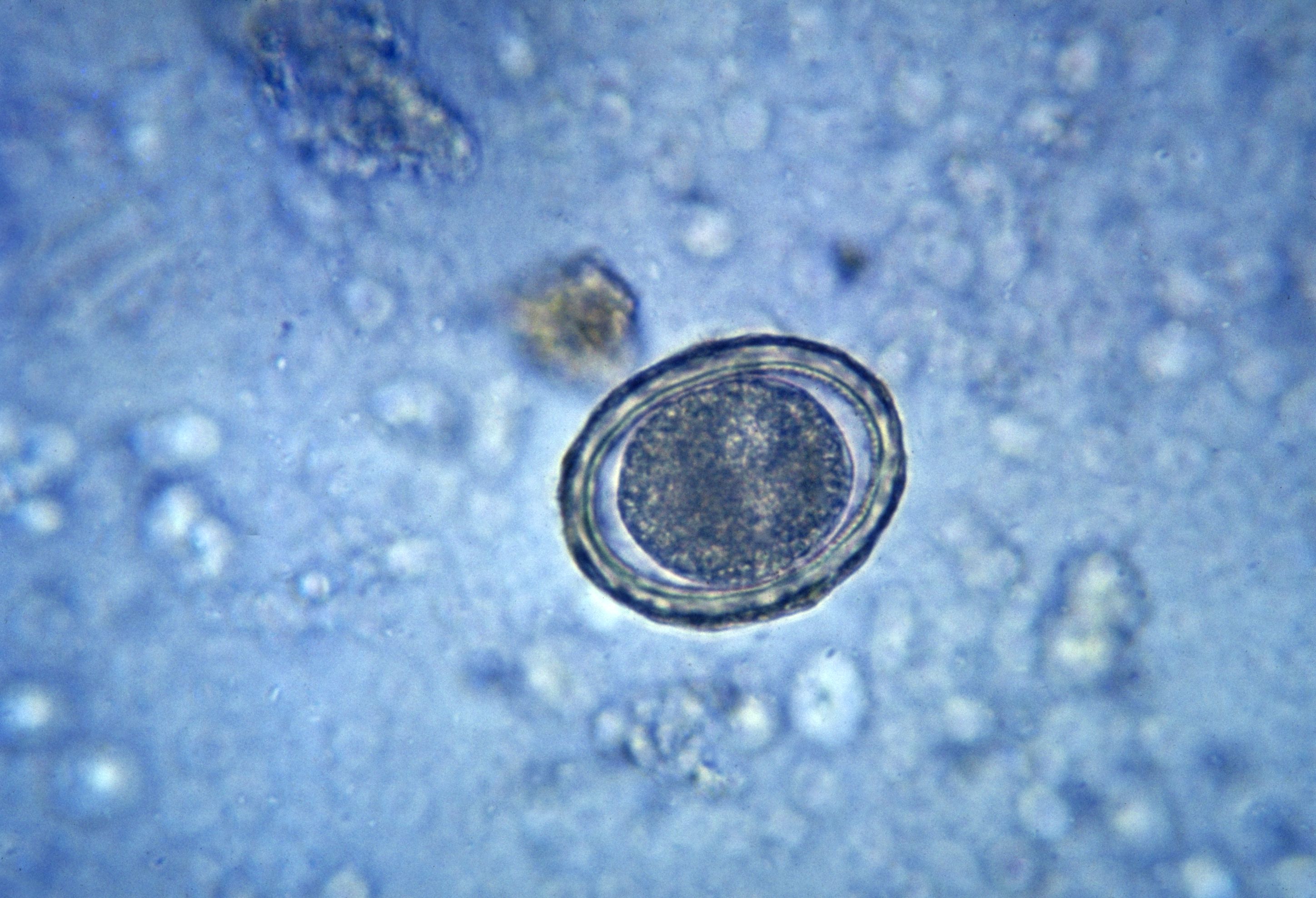 File:Fertilized egg of Ascaris lumbricoides PHIL 410 lores.jpg