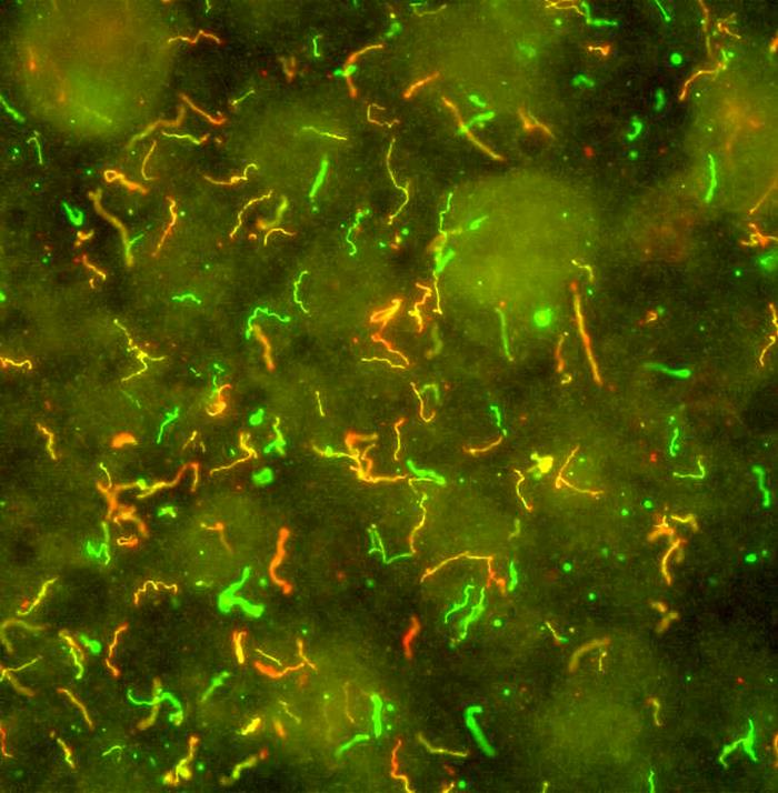 Produced by the National Institute of Allergy and Infectious Diseases (NIAID), this photomicrographic montage was created by combining two slides processed using the immunofluorescent antibody technique (IFA). One slide was used to identify spirochetes that express outer surface protein D, resulting in yellow- and red-colored organisms. Again using IFA on the second slide, spirochetes were labeled with an anti-B. burgdorferi antibody, producing organisms that had stained a glowing green color. The two slides were then combined producing this B. burgdorferi multicolored image. From Public Health Image Library (PHIL). [2]