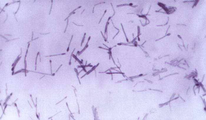 Clostridium innocuum bacteria cultivated in a thioglycollate fluid medium 24hrs (956x mag). From Public Health Image Library (PHIL). [7]
