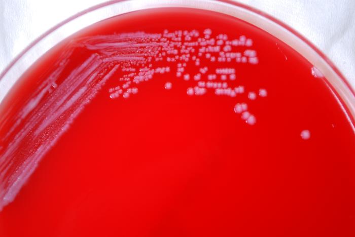 Gram-negative Yersinia pestis bacteria, grown on SBA 72hrs. From Public Health Image Library (PHIL). [6]
