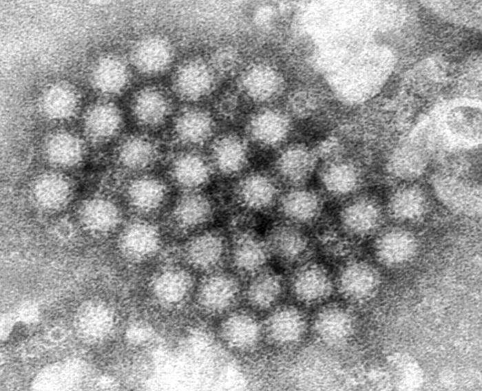 Transmission electron micrograph (TEM) revealed some of the ultrastructural morphology displayed by Norovirus virions. From Public Health Image Library (PHIL). [8]