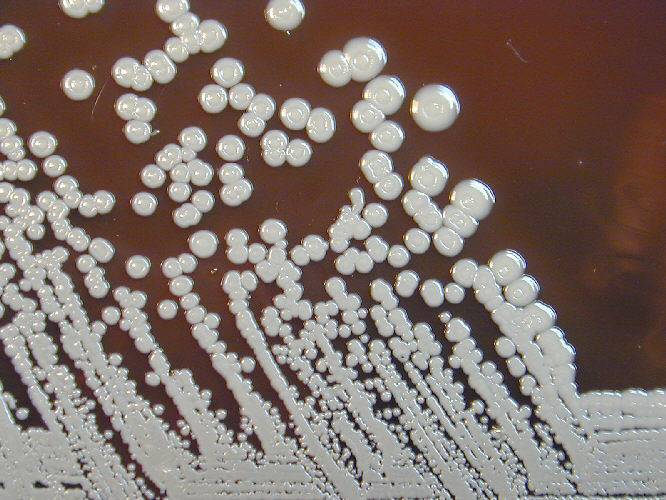 Burkholderia pseudomallei grown on sheep blood agar for 96 hours. From Public Health Image Library (PHIL). [12]