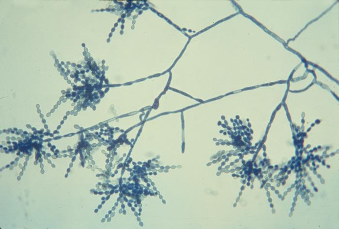 Photomicrograph of Cladophialophora carrionii (475X mag). From Public Health Image Library (PHIL). [2]