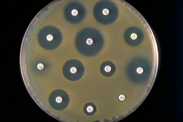 Plate culture of Enterobacter sakazakii performed during an antibiogram study. From Public Health Image Library (PHIL). [7]