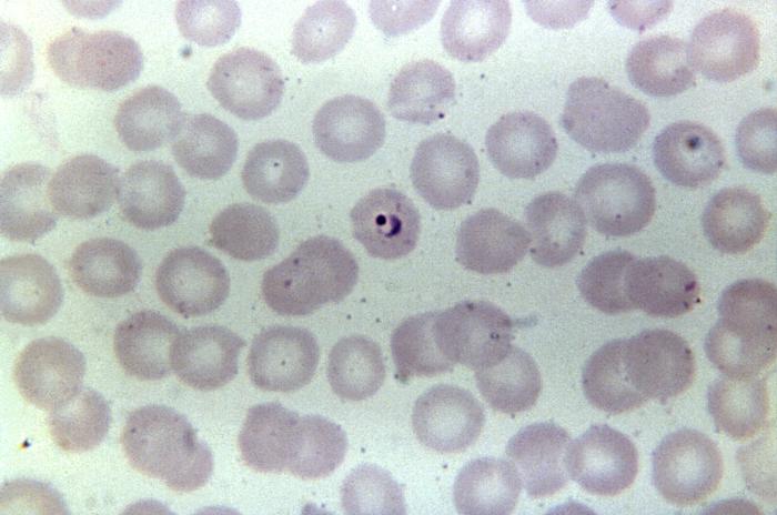 This thin film Giemsa stained micrograph depicts a ring-form Plasmodium ovale trophozoite Adapted from Public Health Image Library (PHIL), Centers for Disease Control and Prevention.[6]