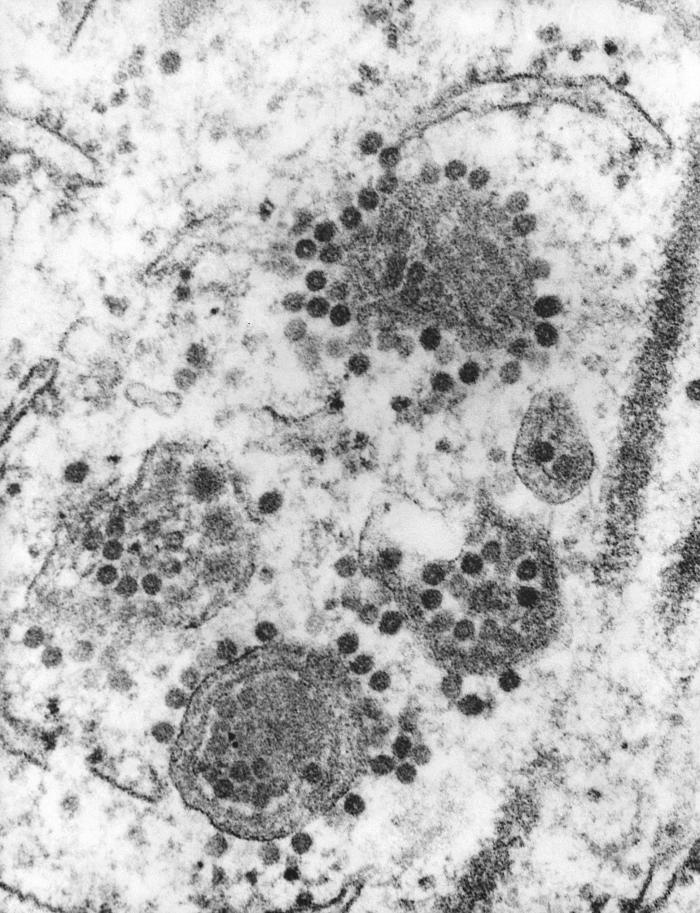 Transmission electron micrograph (TEM) revealed the presence of a number of Eastern Equine Encephalitis (EEE) virus virions that happened to be in a specimen of central nervous system tissue. From Public Health Image Library (PHIL). [1]