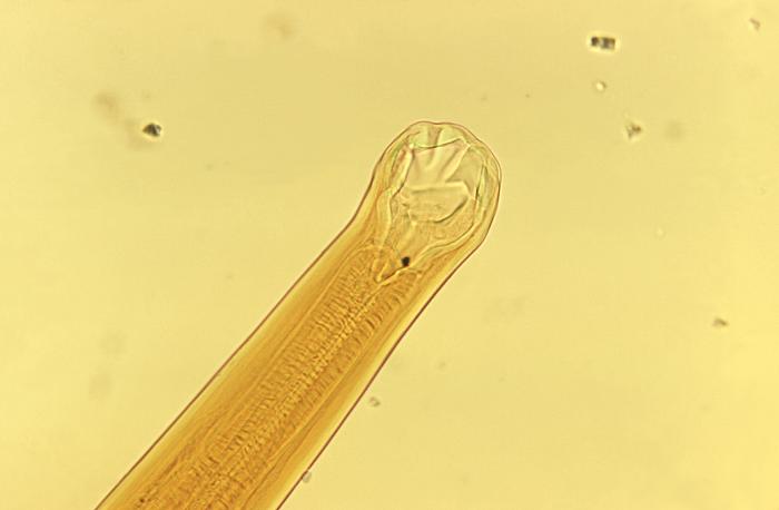 Ancylostoma braziliense mouth parts. From Public Health Image Library (PHIL). [6]