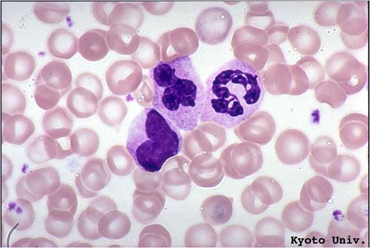 Granulocyte and metamyelocyte