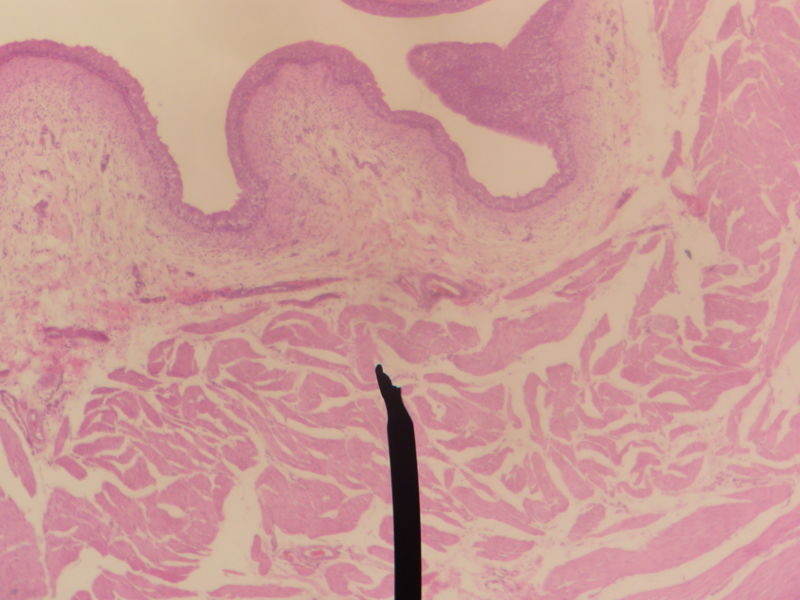 Layers of the urinary bladder wall and cross section of the detrusor muscle.