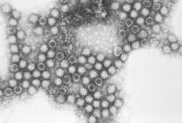 Electron micrograph reveals the morphologic traits exhibited by the feline calicivirus (FCV), a Caliciviridae family member. From Public Health Image Library (PHIL). [16]