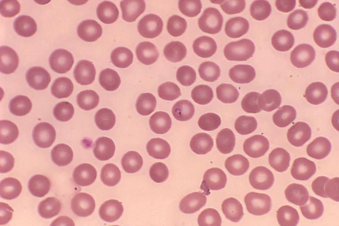 Babesia microti in blood smear. Giemsa stain. Parasite. From Public Health Image Library (PHIL). [2]