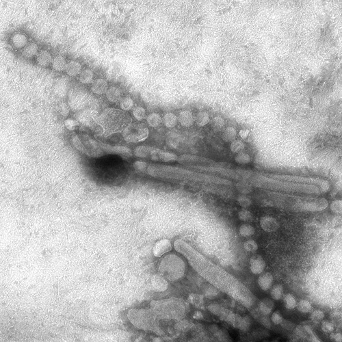Electron Micrograph Images of H7N9 Virus from China. Image obtained from CDC.