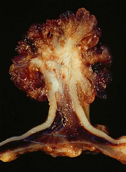 The polyp is shown in longitudinal section