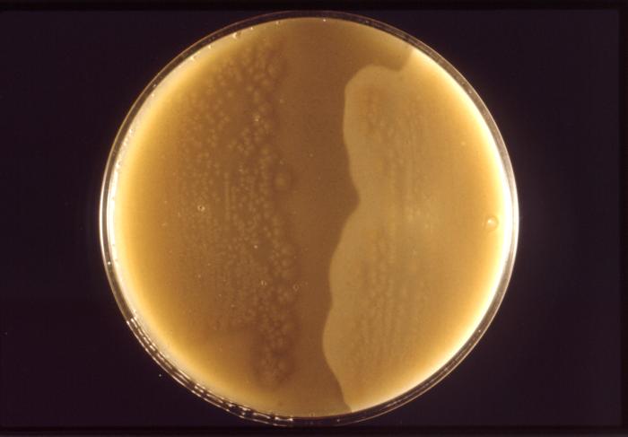 File:Clostridium perfringens12.jpeg