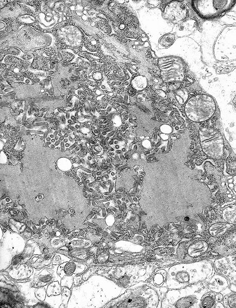 TEM micrograph with numerous rabies virions (small dark-grey rod-like particles) and Negri bodies (the larger pathognomonic cellular inclusions of rabies infection)
