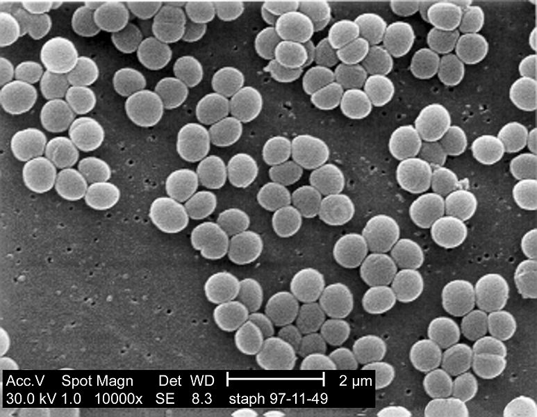 SEM micrograph of S. aureus colonies; note the grape-like clustering common to Staphylococcus species.