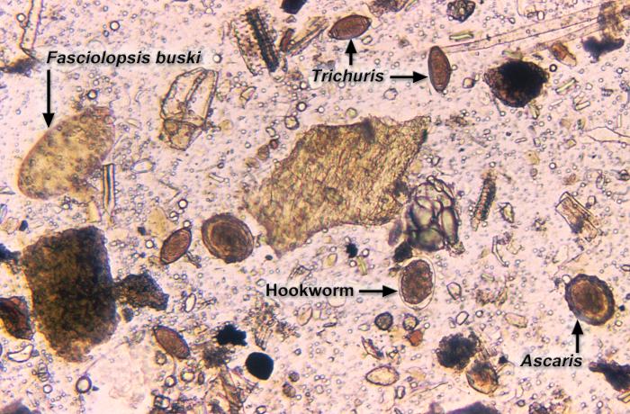 Photomicrograph of fecal sample revealed the presence of a number of parasitic worm eggs, which included the eggs of a trematode, Fasciolopsis buski, an Ascaris sp. nematode, a Trichuris sp. nematode, and an unknown specie of nematodal hookworm (125X mag). From Public Health Image Library (PHIL). [4]