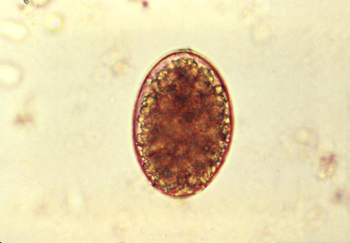 Micrograph reveals an egg of tapeworm cestode parasite Diphyllobothrium latum. From Public Health Image Library (PHIL). [1]