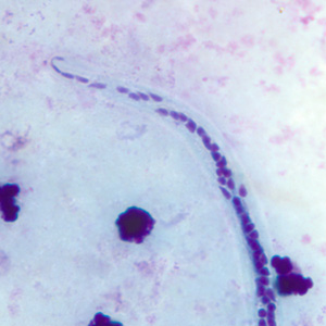 Close-up of the posterior end of the worm in Figure C. Adapted from CDC