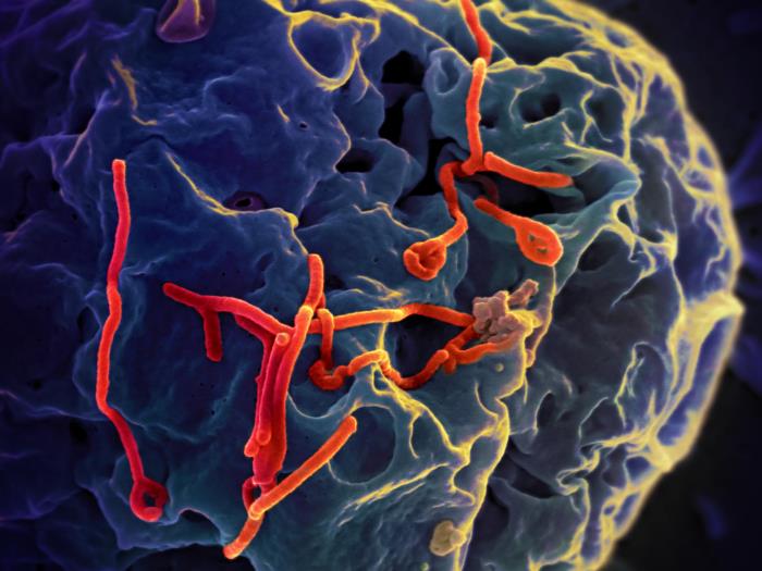 File:Ebolavirus02.jpeg