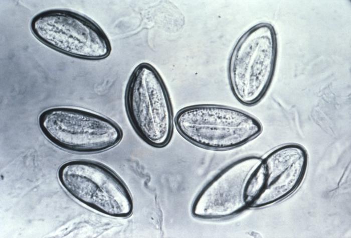 Pinworm eggs are easily seen under a microscope.