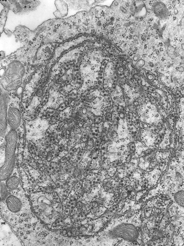 Transmission electron micrograph (TEM) reveals the presence of numerous St. Louis encephalitis (SLE) virions contained inside a neuron. From Public Health Image Library (PHIL). [2]