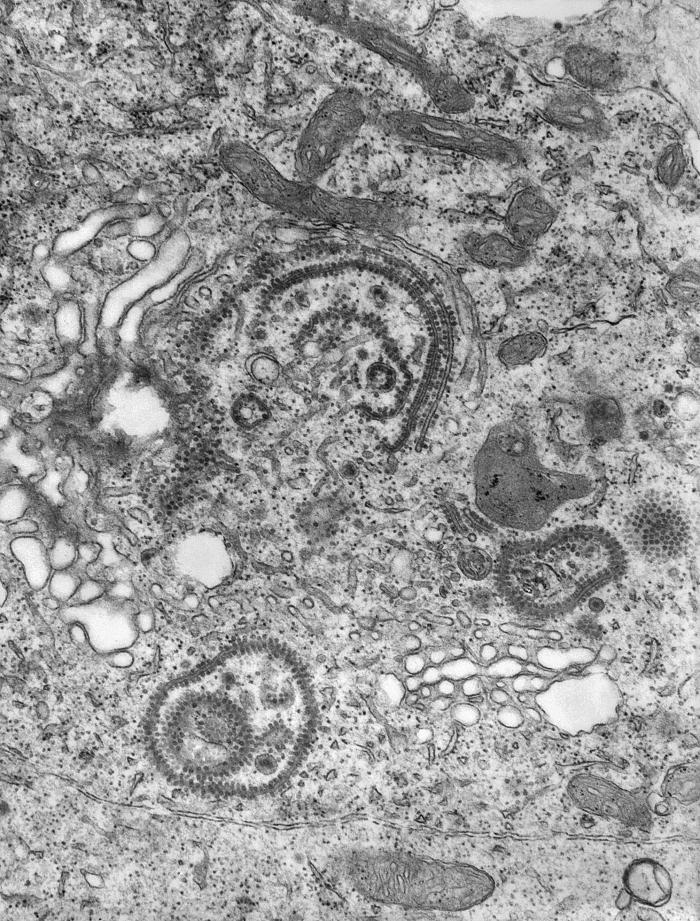 Transmission electron micrograph (TEM) reveals presence of a number of Eastern Equine Encephalitis (EEE) virus virions from a specimen of central nervous system tissue. From Public Health Image Library (PHIL). [1]